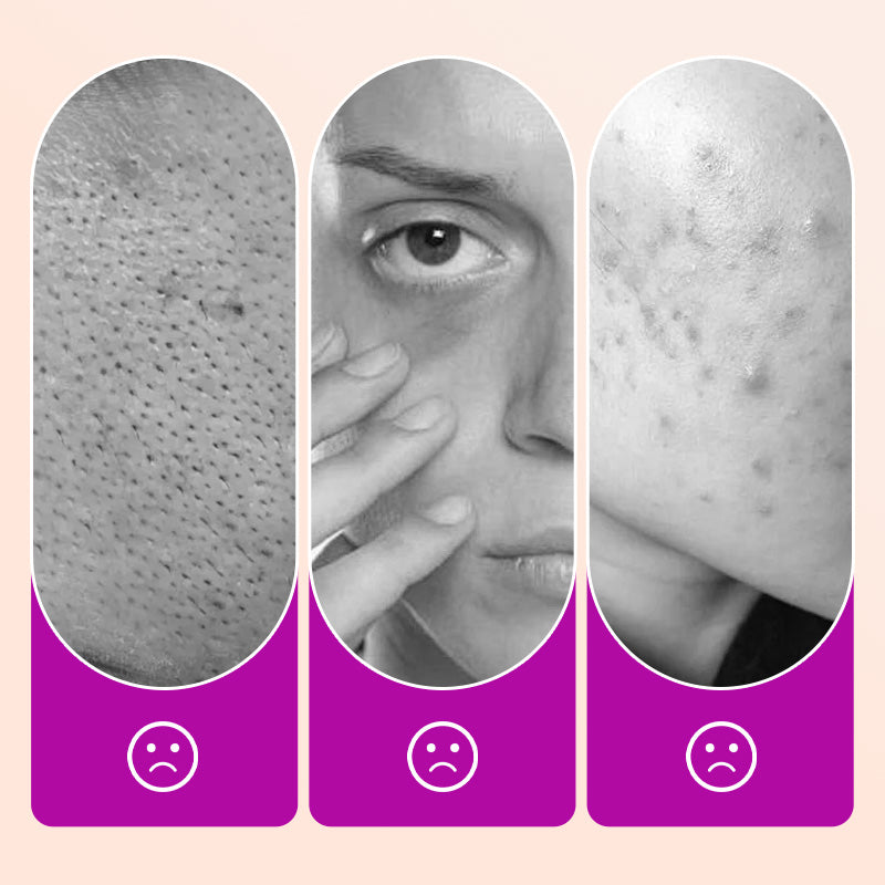 đ„ Flawless Under Eye ConcealerïœBelysa mörka ringar, veck - Free Finish