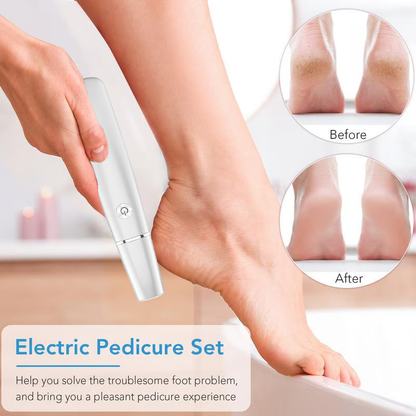 🔥 Elektrisk Fotfil - Effektiv & Skonsam, Perfekt för Mjuka och Välskötta Fötterna ✨
